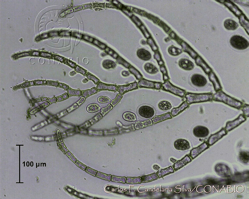 UNAMCCS 0075%20Pleonosporium%20globuliferum.jpg.nyf547n1MSFzgYNhQA3g0JtbmFja29CbnFuZ3NAbXJ6LGtwZwA.bDTFo3ZBEX