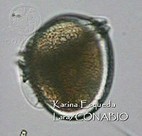 KEL0084 Dinophysis argus.JPG