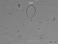 KT018 0256 Surirella ovalis.jpg