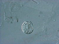 BDP0162 Prorocentrum sp..jpg