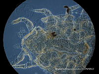 MVG 0662 Uropoda sp..JPG