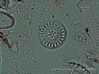KT018 0076 Cyclotella meneghiniana.jpg