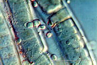 KT018 0043 Chamaecalyx calyculatus.jpg