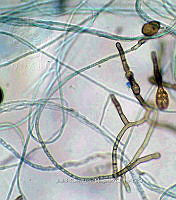 ME008 0014 Alternaria spp..jpg