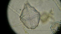 ZME y MEMC-LFMS155 Gonyaulax polygramma.JPG