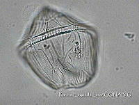 KEL0169 Gonyaulax hyalina.JPG