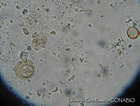 LCR0036 Trachelomona sp..jpg