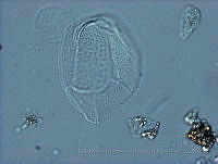 EDISyBDP027 Ostreopsis marinus.jpg