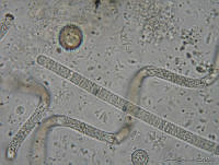 LCR0030 Spirulina sp..jpg