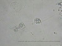 ZME y MEMC-LFMS197 Chaetoceros rostratus.JPG