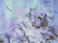 ME008 0117 Cladosporium.jpg