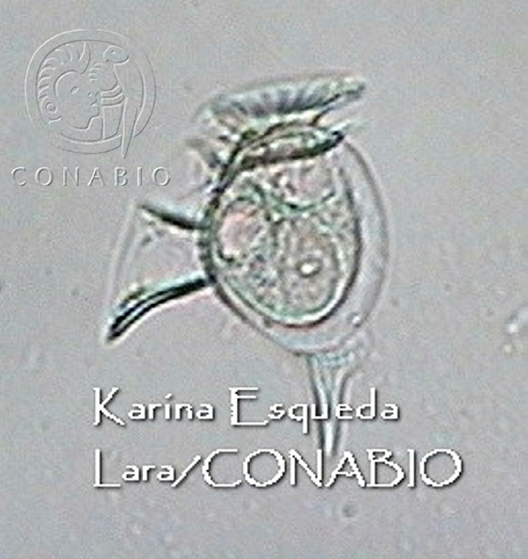 KEL0085%20Dinophysis%20balechii.JPG.jCeC1Yv0MYUht4NhQA3g0JtbmFja29CbnFuZ3NAbXJ6LGtwZwA.qtF19k J0Z