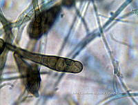 ME008 0017 Alternaria spp..jpg