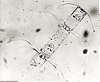 DUHB0040 Bacteriastrum comosum.png