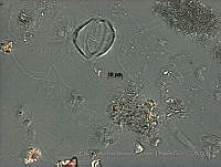 EDISyBDP003 Bysmatrum sp..jpg