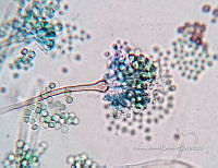 ME008 0067 Aspergillus.jpg
