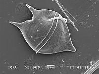 ZME y MEMC-LFMS268 Protoperidinium claudicans.JPG
