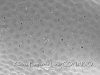 KEL0292 Phalacroma oxytoxoides.JPG