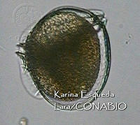 KEL0083 Dinophysis argus.JPG