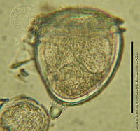 DJ017-69 Dinophysis doryphora.jpg