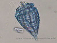 ZME y MEMC-LFMS295 Corythodinium tesselatum.JPG