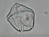 KEL0168 Gonyaulax hyalina.JPG