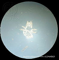 MVG 0673 Uropodina.JPG