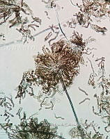ME008 0063 Aspergillus.jpg