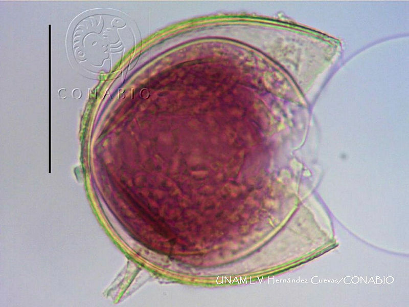 JF068%200745%20Acaulospora%20morrowiae.jpg.iieOn7f1MSV1o 9hQA3g0JtbmFja29CbnFuZ3NAbXJ6LGtwZwA.q5iiRDx T7