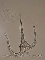 ZME y MEMC-LFMS296 Ceratium horridum.JPG