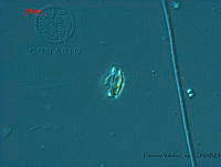 FVC0120 Chaetoceros affinis.jpg
