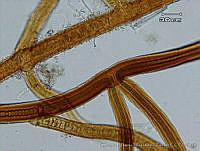 UNAMGAMZ-63 Scytonema sp..jpg