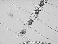 DUHB0074 Chaetoceros densus.png