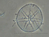 ZME y MEMC-LFMS279 Asteromphalus heptactis.JPG