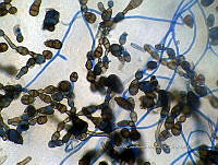 ME008 0019 Alternaria spp..jpg