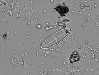 KT018 0154 Luticola charlati.jpg