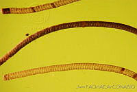 OIEA0022 Cactoblastis cactorum.jpg