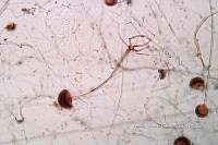 ME008 0318 Rhizopus spp..jpg