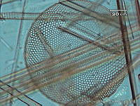 UNAMECU-4 Actinocyclus normanii.jpg
