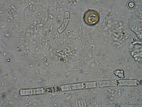 LCR0017 Planktothrix.jpg