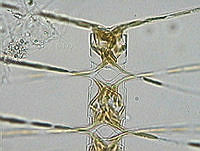 DUHB0078 Chaetoceros denticulatus.JPG