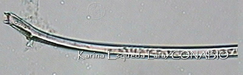 KEL0011%20Amphisolenia%20bidentata.JPG.jCfxhov0MX37tYNhQA3g0JtbmFja29CbnFuZ3NAbXJ6LGtwZwA.aQ1dKfcmTM