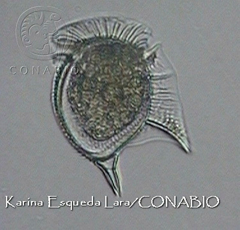 KEL0111%20Dinophysis%20monacantha.JPG.jCeq Yr0MZGNt4NhQA3g0JtbmFja29CbnFuZ3NAbXJ6LGtwZwA.OItoPcaAYA