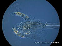 MVG 0661 Uropoda sp..JPG