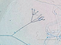ME008 0258 Paecilomyces spp..jpg