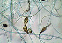 ME008 0028 Alternaria spp..jpg