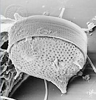 DUHB0057 Cerataulus smithii.png