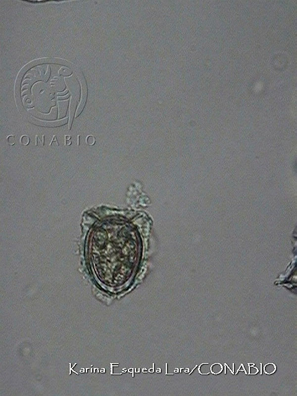 KEL0097%20Dinophysis%20exigua.JPG.jCfEp4f0MfllDYVhQA3g0JtbmFja29CbnFuZ3NAbXJ6LGtwZwA.YKuxlkjcAm