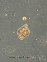 JSP137 Gonyaulax polygramma.JPG