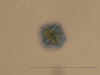 ZME y MEMC-LFMS020 Lingulodinium polyedra.JPG